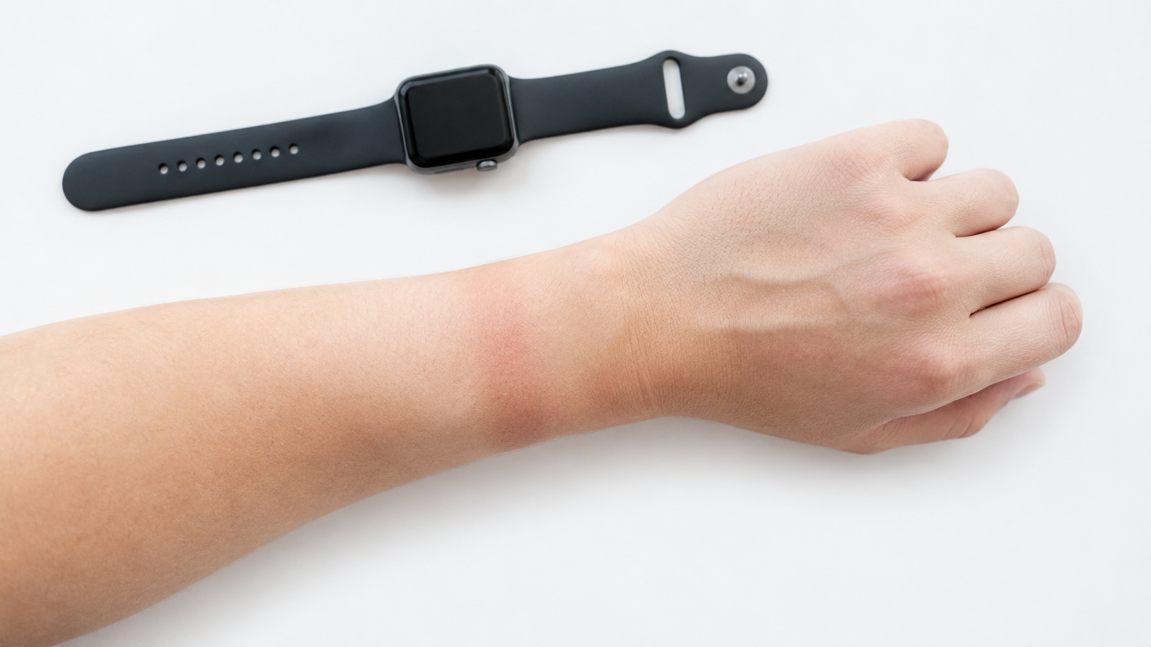 Bracelet Apple Watch qui irrite : causes et solutions Image
